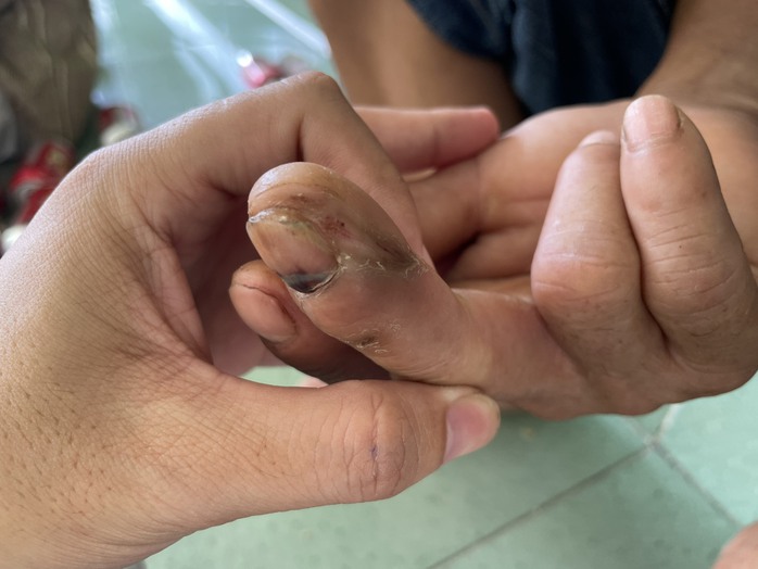 PHÓNG SỰ: Đời phu trầm ở xứ trầm hương- Ảnh 6. PHÓNG SỰ: Đời phu trầm ở xứ trầm hương- Ảnh 6.