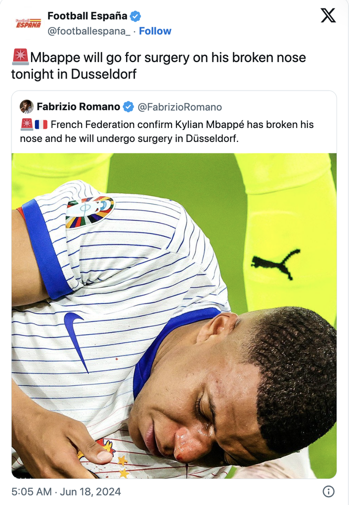 Euro 2024: Kylian Mbappe gẫy xương mũi, nhập viện phẫu thuật khẩn cấp- Ảnh 6. Euro 2024: Kylian Mbappe gẫy xương mũi, nhập viện phẫu thuật khẩn cấp- Ảnh 6.