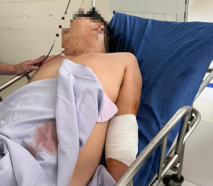 Điều tra vụ tài xế xe tải bị chém nhập viện tại Đà Nẵng- Ảnh 1. Điều tra vụ tài xế xe tải bị chém nhập viện tại Đà Nẵng- Ảnh 1.