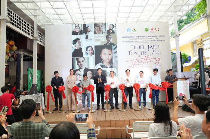 Á hậu Lệ Hằng động viên bệnh nhân bạch biến- Ảnh 3. Á hậu Lệ Hằng động viên bệnh nhân bạch biến- Ảnh 3.