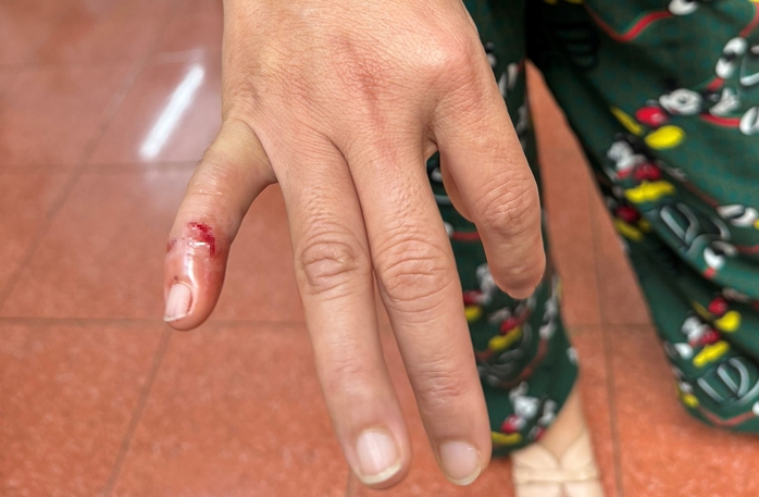 CLIP: Con chó lạ lao vào cắn nhiều người dân bị thương- Ảnh 1. CLIP: Con chó lạ lao vào cắn nhiều người dân bị thương- Ảnh 1.