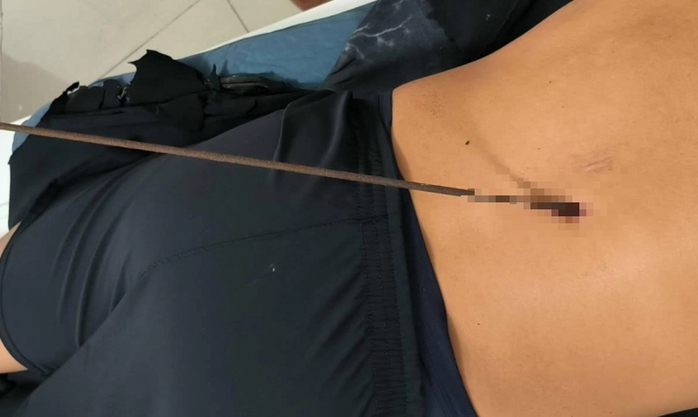 Đi săn cá dưới biển, 1 người bị mũi tên đâm xuyên phổi- Ảnh 1. Đi săn cá dưới biển, 1 người bị mũi tên đâm xuyên phổi- Ảnh 1.