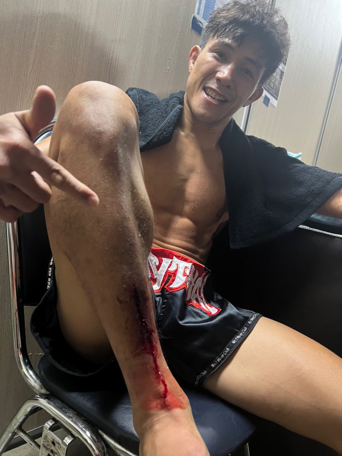 Đánh đổi của Duy Nhất khi thắng thần đồng Malaysia tại ONE Championship- Ảnh 1. Đánh đổi của Duy Nhất khi thắng thần đồng Malaysia tại ONE Championship- Ảnh 1.