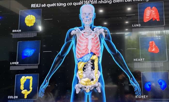 Trung tâm tầm soát ung thư bằng AI đầu tiên tại Việt Nam- Ảnh 2. Trung tâm tầm soát ung thư bằng AI đầu tiên tại Việt Nam- Ảnh 2.