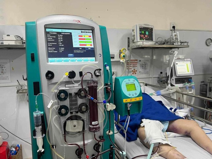 Bệnh nhân được lọc độc chất sau 2 ngày đã qua cơn nguy kịch. (Ảnh do bệnh viện cung cấp) Bệnh nhân được lọc độc chất sau 2 ngày đã qua cơn nguy kịch. (Ảnh do bệnh viện cung cấp)