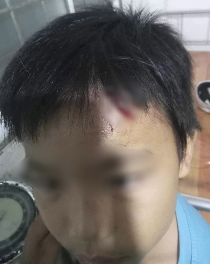 Điều tra vụ bé trai 10 tuổi nghi bị mẹ kế tiếp tục bạo hành- Ảnh 1. Điều tra vụ bé trai 10 tuổi nghi bị mẹ kế tiếp tục bạo hành- Ảnh 1.