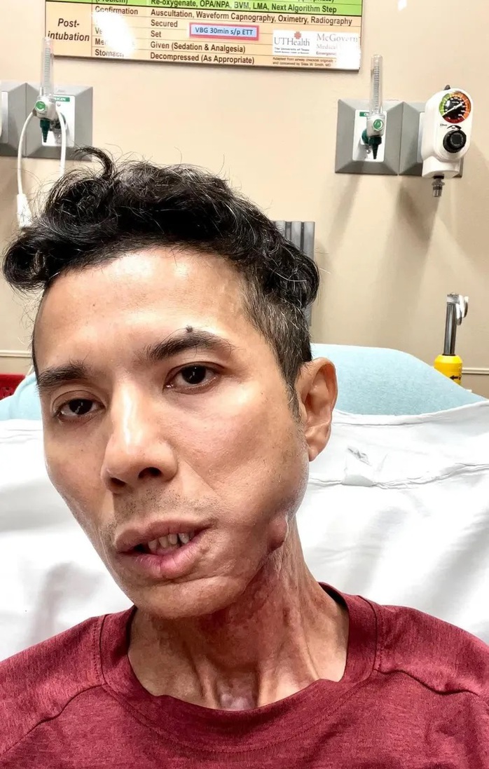 Nhìn Kasim Hoàng Vũ mà thương!- Ảnh 1. Nhìn Kasim Hoàng Vũ mà thương!- Ảnh 1.