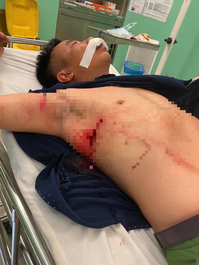 Thiếu tá công an bị chém trọng thương trong đêm- Ảnh 2. Thiếu tá công an bị chém trọng thương trong đêm- Ảnh 2.