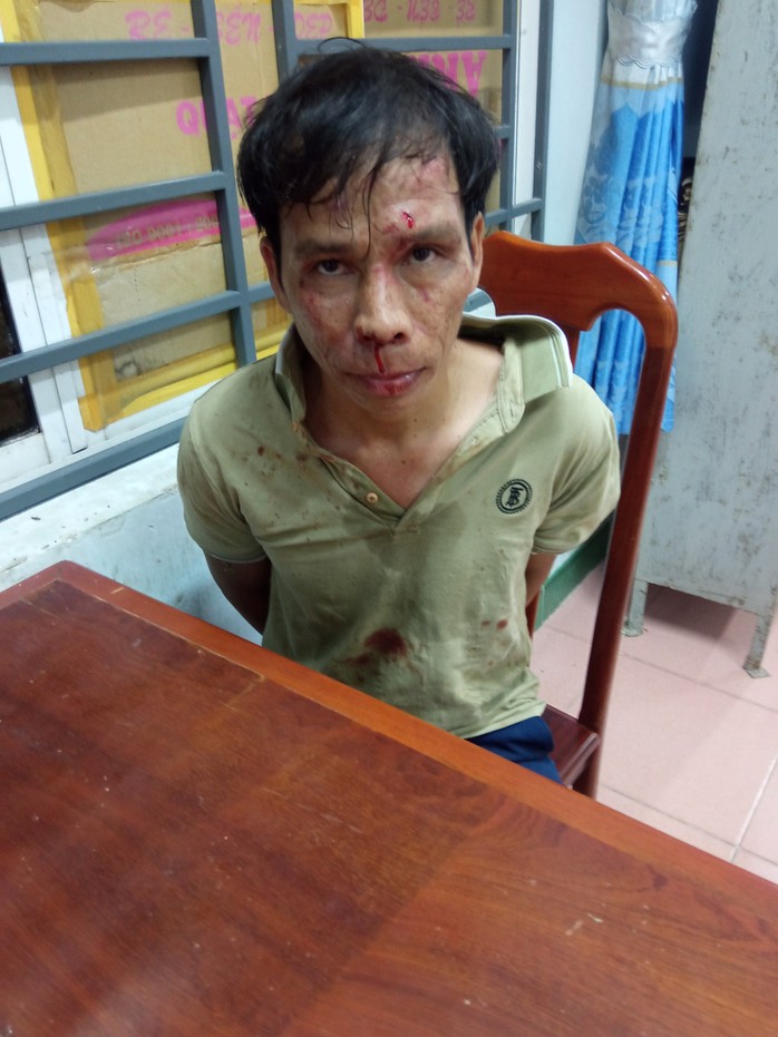 Thiếu tá công an bị chém trọng thương trong đêm- Ảnh 1. Thiếu tá công an bị chém trọng thương trong đêm- Ảnh 1.