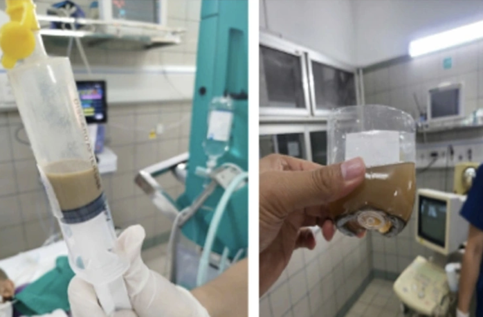 Hội chẩn với chuyên gia Nhật cứu cháu bé vụ lũ quét- Ảnh 2. Hội chẩn với chuyên gia Nhật cứu cháu bé vụ lũ quét- Ảnh 2.