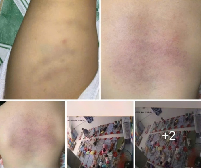 Vụ cháu bé bị bạo hành ở Bình Thuận: Chủ nhóm trẻ xin lỗi, mong được tha thứ- Ảnh 1. Vụ cháu bé bị bạo hành ở Bình Thuận: Chủ nhóm trẻ xin lỗi, mong được tha thứ- Ảnh 1.