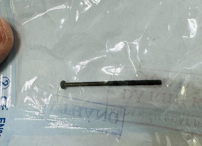Gắp đinh sắt dài 4 cm trong dạ dày bé 3 tuổi- Ảnh 1. Gắp đinh sắt dài 4 cm trong dạ dày bé 3 tuổi- Ảnh 1.