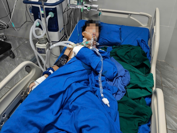 Tự chế tạo pháo, học sinh lớp 10 bị nổ nát bàn tay- Ảnh 3. Tự chế tạo pháo, học sinh lớp 10 bị nổ nát bàn tay- Ảnh 3.