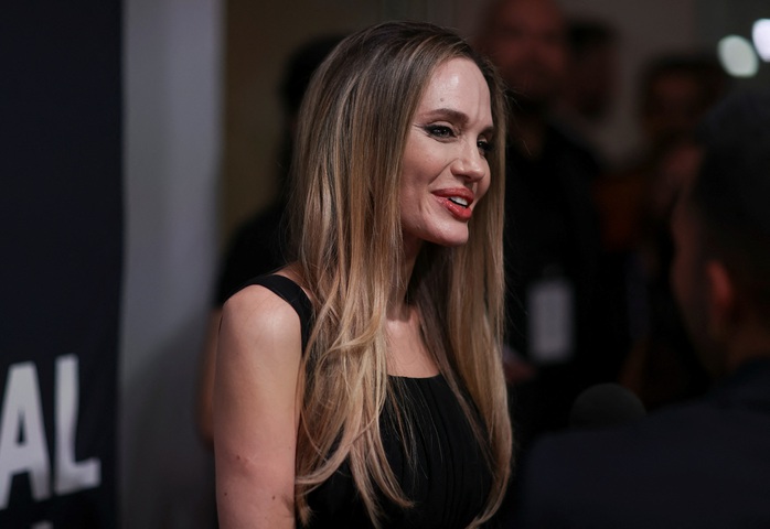 Pax Thiên lộ sẹo khi tháp tùng mẹ nuôi Angelina Jolie- Ảnh 5. Pax Thiên lộ sẹo khi tháp tùng mẹ nuôi Angelina Jolie- Ảnh 5.