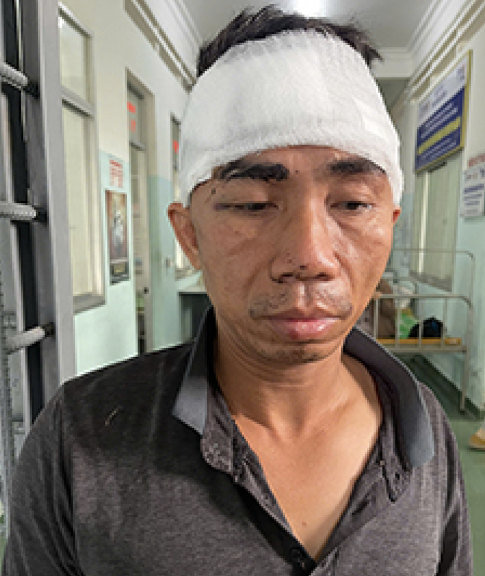 Công an Bình Định bắt nóng tên cướp tiệm vàng sau 2 giờ gây án- Ảnh 1. Công an Bình Định bắt nóng tên cướp tiệm vàng sau 2 giờ gây án- Ảnh 1.