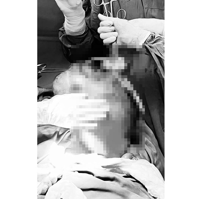 Thấy bụng to bất thường, người phụ đi khám thì phát hiện điều bất ngờ - Ảnh 1.