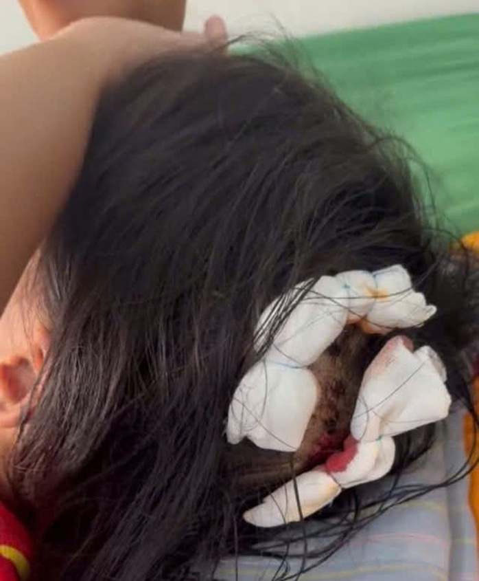 Vụ bé gái lớp 5 ở Hà Tĩnh bị bạo hành: Công an làm việc với cha dượng  - Ảnh 3.