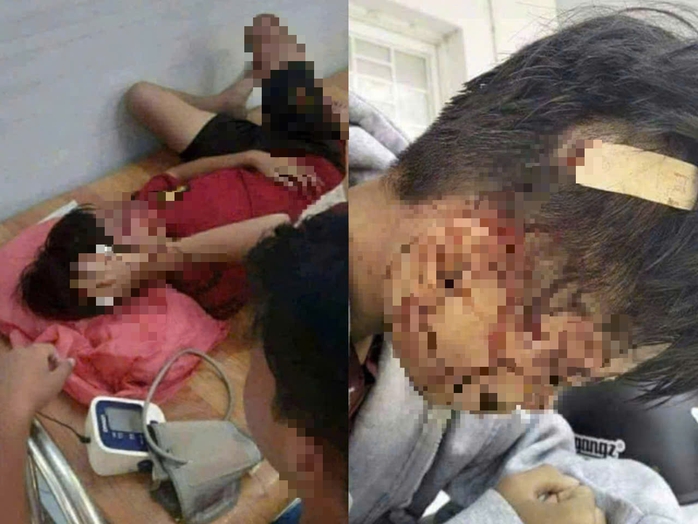 Nam sinh ở An Giang cầm hung khí quật liên tiếp vào đầu bạn - Ảnh 1.