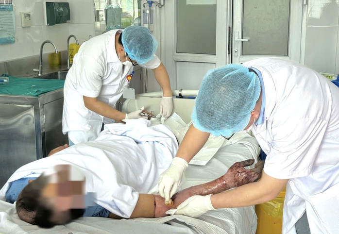 Giữ thang giúp hàng xóm, người đàn ông bị bỏng điện kinh hoàng - Ảnh 1.