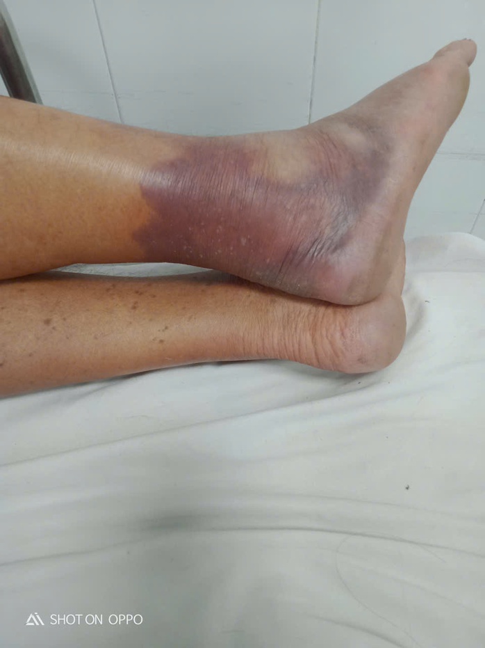 Cái chết của Người đàn ông ở Đà Nẵng chưa xác định nguyên nhân do tiêm thuốc - Ảnh 3. Cái chết của Người đàn ông ở Đà Nẵng chưa xác định nguyên nhân do tiêm thuốc - Ảnh 3.