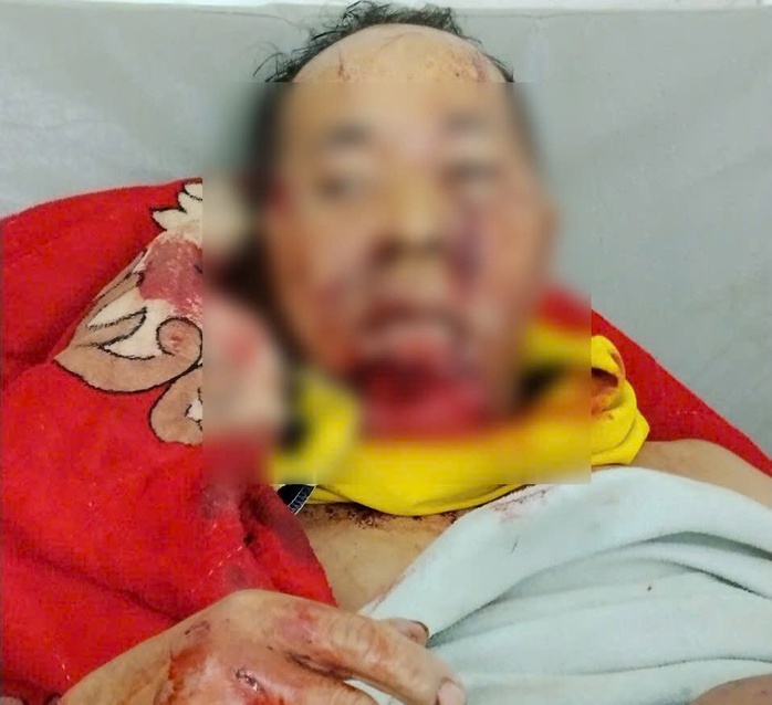 Trưởng thôn Đà Nẵng bị gấu rừng tấn công khiến nhiều người lo lắng - Ảnh 1. Trưởng thôn Đà Nẵng bị gấu rừng tấn công khiến nhiều người lo lắng - Ảnh 1.