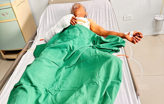 Công an thông tin vụ đôi nam nữ bị truy sát trong phòng trọ - Ảnh 1.