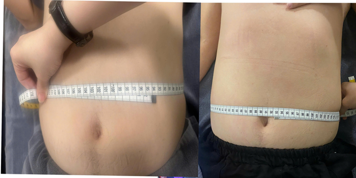 Góc khuất "công nghệ" thẩm mỹ: Dụ dỗ, chèo kéo và ép đặt cọc giảm cân thần tốc - Ảnh 4. Góc khuất "công nghệ" thẩm mỹ: Dụ dỗ, chèo kéo và ép đặt cọc giảm cân thần tốc - Ảnh 4.