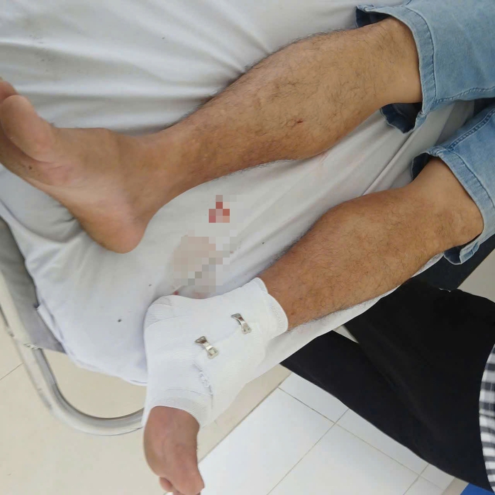 Vụ cá sấu sổng chuồng cắn thầy giáo ở Tây Ninh: Bất ngờ lời khai của người nuôi - Ảnh 2.