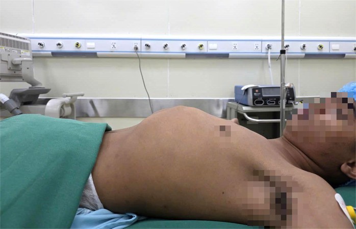 Thanh niên mắc "bệnh lạ", tỉ lệ 1/1.000 người - Ảnh 1.