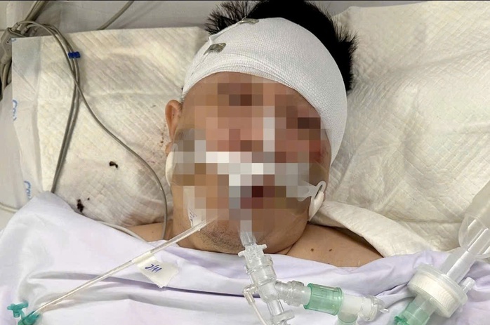 Luật sư lên tiếng vụ nam thanh niên nguy kịch khi xe tông trúng chó chạy rông - Ảnh 1.