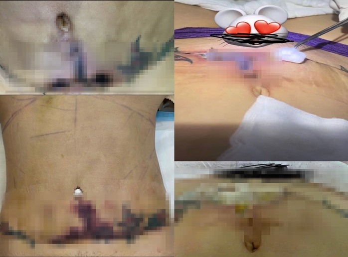 Từ điều tra Góc khuất "công nghệ" thẩm mỹ: Thêm nạn nhân khiếu nại CEO Nhã Lê và JT Angel - Ảnh 2.