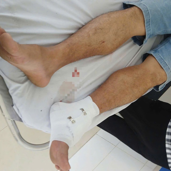 Hốt hoảng cá sấu dài 2m dính lưới trên sông Cái Cỏ Tây Ninh - Ảnh 3.