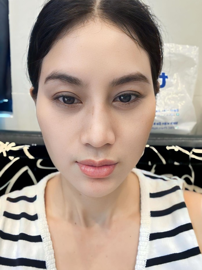 "Bóng hồng" cascadeur bị đánh máu đầy mặt viết tâm thư xin lỗi - Ảnh 1.