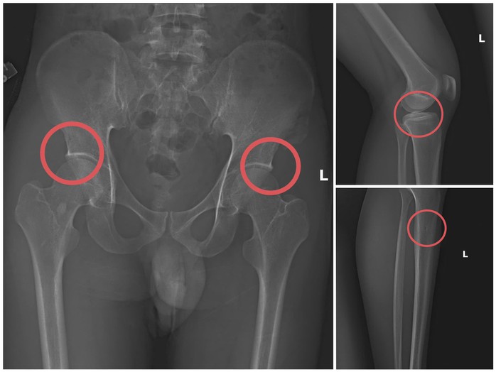Nguyên cán bộ y tế, cầm đầu đường dây chuyên dùng búa đập vỡ xương, chiếm đoạt tiền bảo hiểm - Ảnh 2.