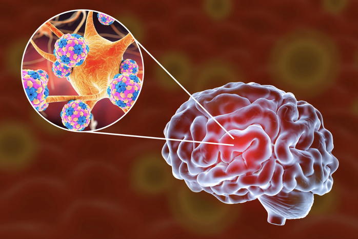 Talkshow: “Sự nguy hiểm của viêm màng não – phát hiện và điều trị ra sao? - Ảnh 1.