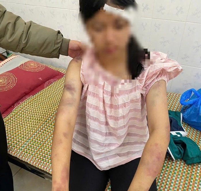 Bé gái bị gia đình nội tra tấn: - Ảnh 1.