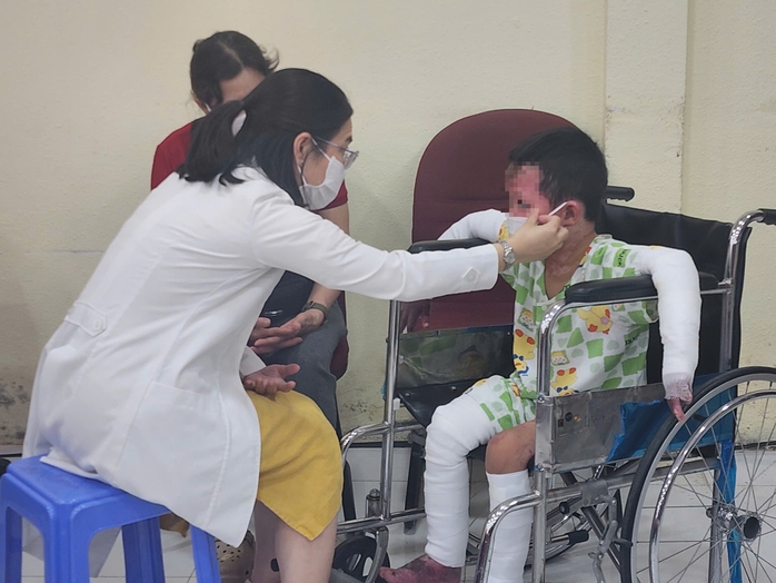 Bé trai 5 tuổi sống sót kỳ diệu sau vụ hỏa hoạn cướp đi cha mẹ, vượt qua bỏng 65% cơ thể - Ảnh 1.