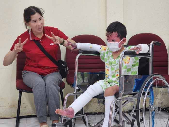 Bé trai 5 tuổi sống sót kỳ diệu sau vụ hỏa hoạn cướp đi cha mẹ, vượt qua bỏng 65% cơ thể - Ảnh 2.