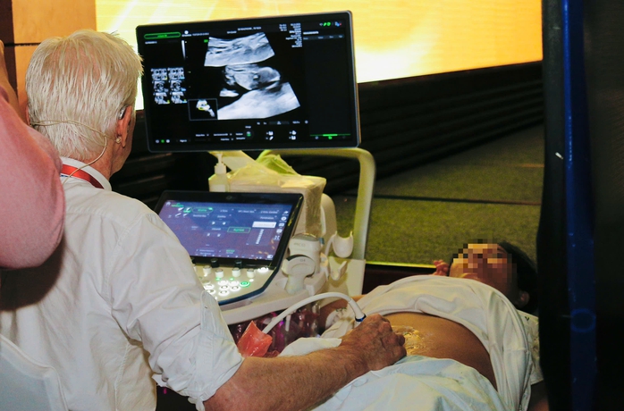 Chẩn đoán bất thường thai sớm nâng chất lượng dân số - Ảnh 2.