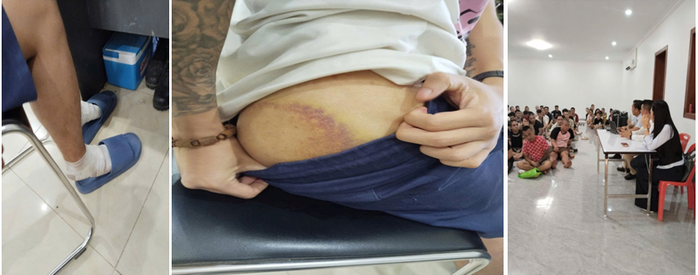 Giải cứu công dân Hưng Yên khỏi hành hạ tại Campuchia: Cuộc sống trở lại - Ảnh 2. Giải cứu công dân Hưng Yên khỏi hành hạ tại Campuchia: Cuộc sống trở lại - Ảnh 2.