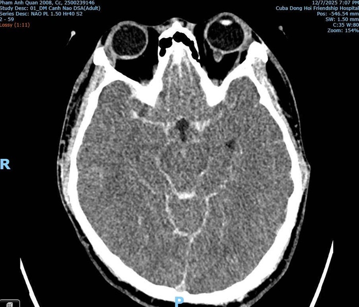 Bác sĩ bất ngờ lý giải nguyên nhân tử vong của thiếu niên xô xát ở quán bida Ba Đồn - Ảnh 2. Bác sĩ bất ngờ lý giải nguyên nhân tử vong của thiếu niên xô xát ở quán bida Ba Đồn - Ảnh 2.
