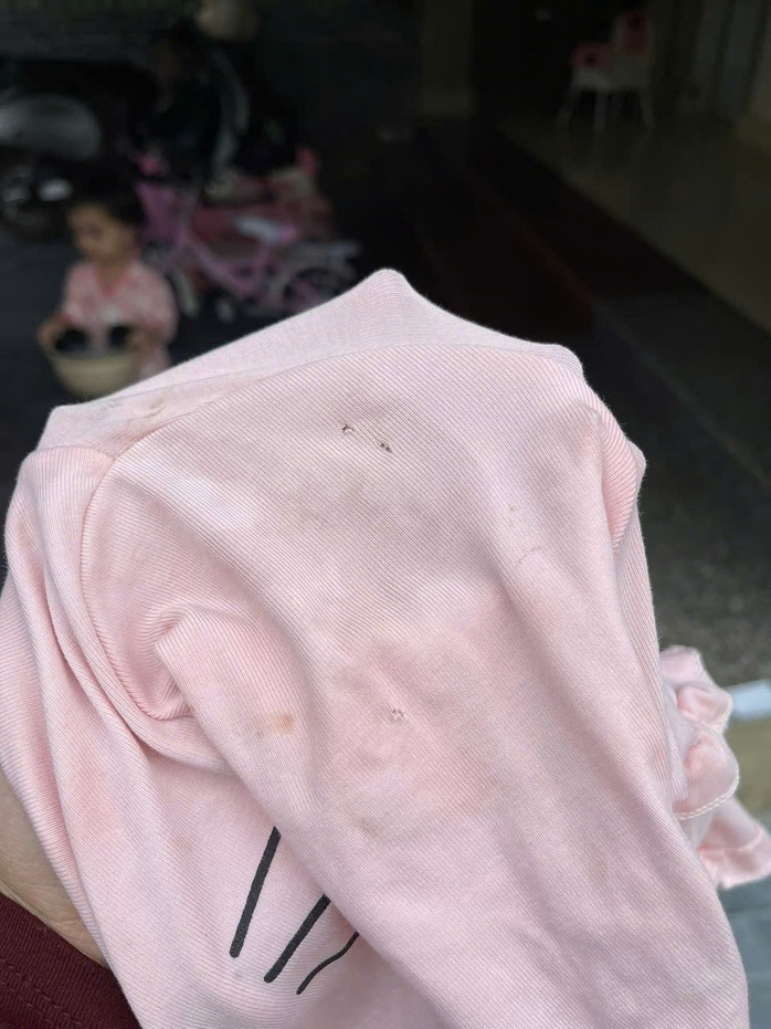 Phụ huynh bức xức khi ph&aacute;t hiện con g&aacute;i hơn 2 tuổi c&oacute; nhiều vết cắn, bầm t&iacute;m tr&ecirc;n cơ thể sau khi đi học về  - Ảnh 3.