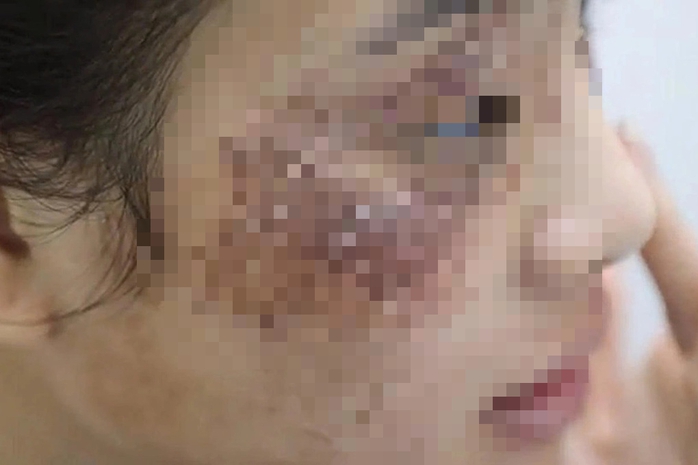 Nát mặt do mua mỹ phẩm trên mạng - Ảnh 1.