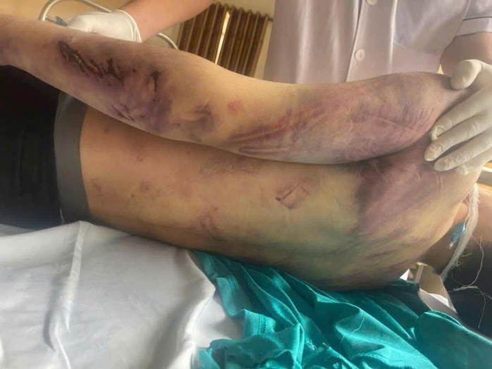 Tạm giữ 8 người li&ecirc;n quan đến vụ học vi&ecirc;n tử vong tại trung t&acirc;m C&ocirc;ng t&aacute;c x&atilde; hội Hải H&agrave; - Ảnh 1.