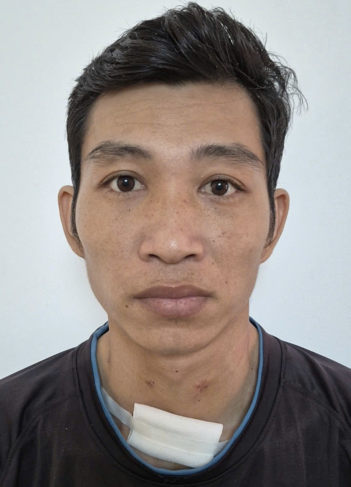 Kẻ s&aacute;t hại người y&ecirc;u v&igrave; Ghen tu&ocirc;ng v&agrave; tự s&aacute;t bất th&agrave;nh ở Đồng Nai - Ảnh 1.