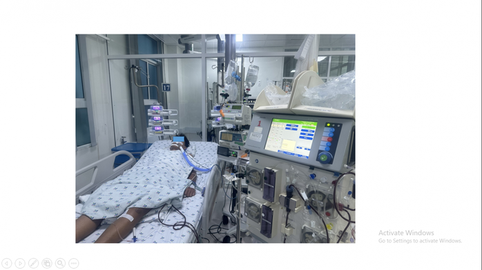 Biến chứng hiếm của căn bệnh thường gặp: hơn 40 năm thế giới chỉ ghi nhận 70 trường hợp - Ảnh 1.