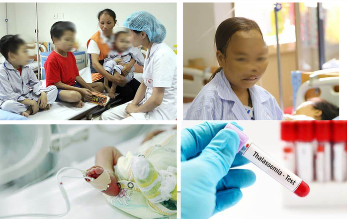 13% d&acirc;n số Việt Nam mang gene bệnh thalassemia - Ảnh 1.