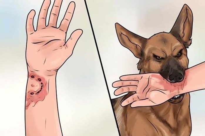 Đồng Nai có trường hợp tử vong sau gần 1 năm bị chó cắn- Ảnh 1. Đồng Nai có trường hợp tử vong sau gần 1 năm bị chó cắn- Ảnh 1.