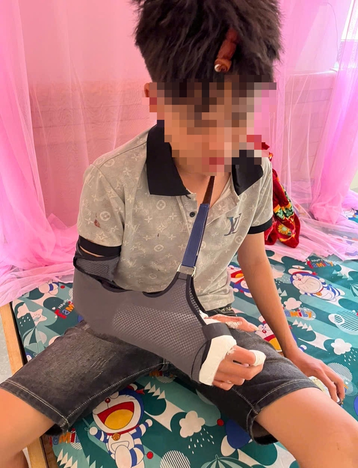 Thiếu niên 14 tuổi dùng gậy sắt đánh thiếu niên 16 tuổi bị thương- Ảnh 1. Thiếu niên 14 tuổi dùng gậy sắt đánh thiếu niên 16 tuổi bị thương- Ảnh 1.