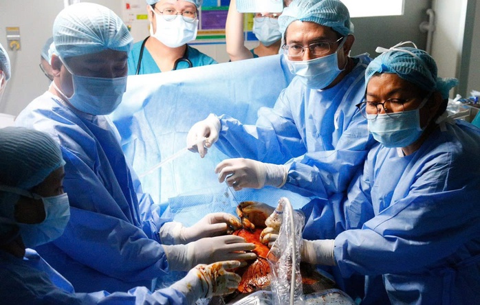 Những giây phút căng thẳng, “cân não” trong quá trình can thiệp bào thai Những giây phút căng thẳng, “cân não” trong quá trình can thiệp bào thai